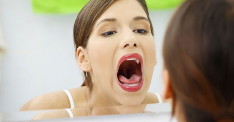 autoexame-boca- câncer de boca